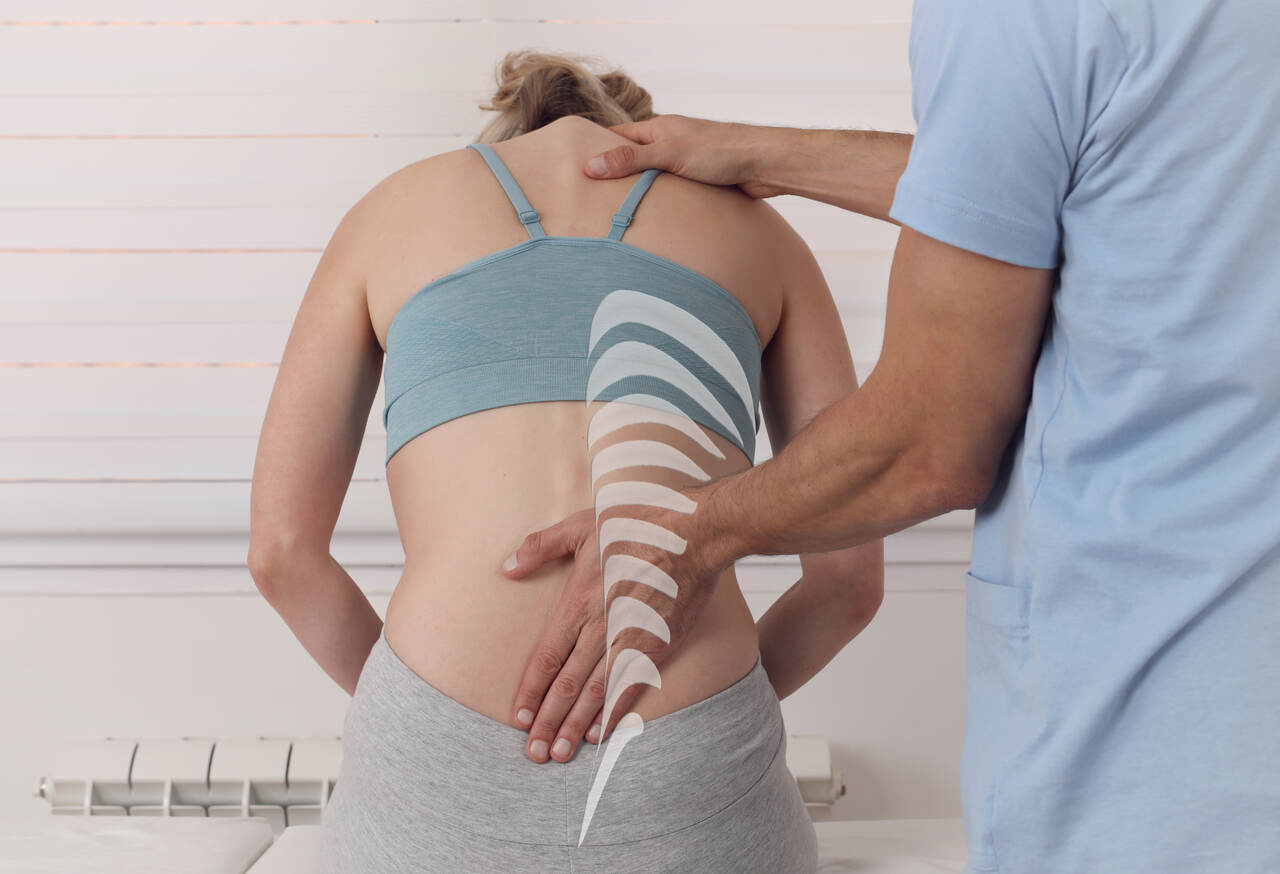 physiotherapy for postural correction