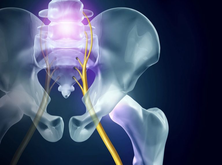 navigating spinal stenosis enhancing joint mobility relieve nerve compression